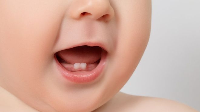 ¿Cuándo sale el primer diente y cuáles son los síntomas?